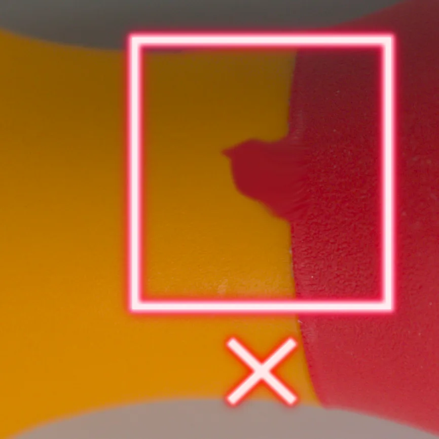 KI Medizintechnik Anomalieerkennung